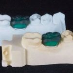 Per modelli dentali accurati biocompatibili